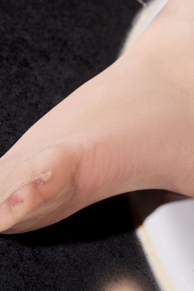 成都甲状腺肿大治疗专业医院|足球比分直播网